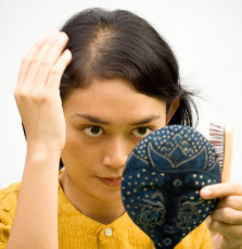Young lady with balding spot on top of head